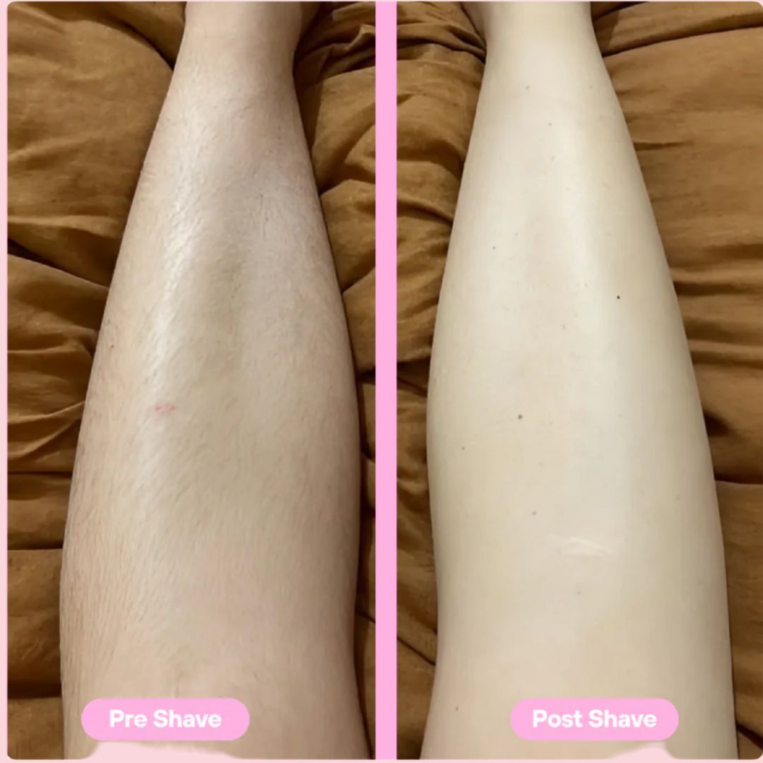 Zentrova Glide Zona Bikini